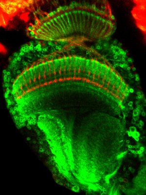 A strain of flies was generated with fluorescent brain cells A strain of flies was generated with fluorescent brain cells